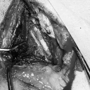 A close-up of a surgical incision, skilfully managed by veterinary professionals, displaying layers of tissue and precision instruments.