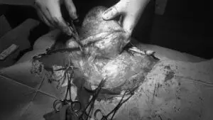 At the Veterinary Referral Clinic, three specialists are diligently collaborating on a surgical procedure. Gloved hands carefully hold tissue, surrounded by an array of instruments on a covered medical table.