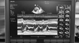 The monochrome ultrasound screen at the Vet Referral Clinic shows heart activity through waveforms and several small image panels on the right side, expertly analysed by our three RCVS Advanced Practitioners.